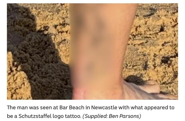 A picture of a man’s ankle with a couple of dark, heavily blurred blotches. Caption: “The man was seen at Bar Beach in Newcastle with what appeared to be a Schutzstaffel logo tattoo. (Supplied: Ben Parsons)”