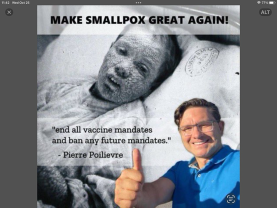 Child lying in bed, dying of smallpox. In the foreground, a picture of Pierre Poilievre, smiling with a thumbs up and the caption: End all vaccine mandates and any future mandates.