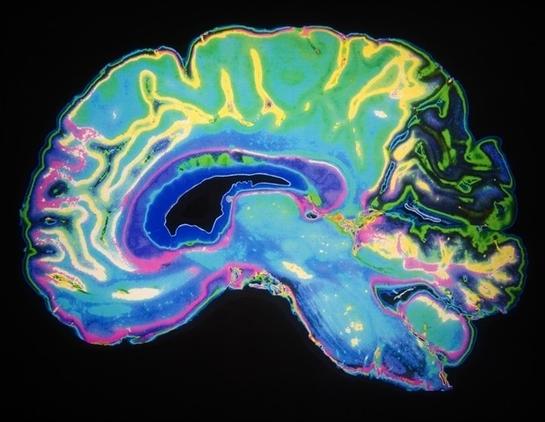 Mapping vulnerability or resilience in Alzheimer's through imaging and genetics