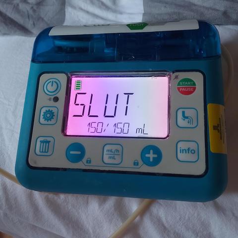 Gastrostomy pump with the screen saying "SLUT" & "150/150 mL"