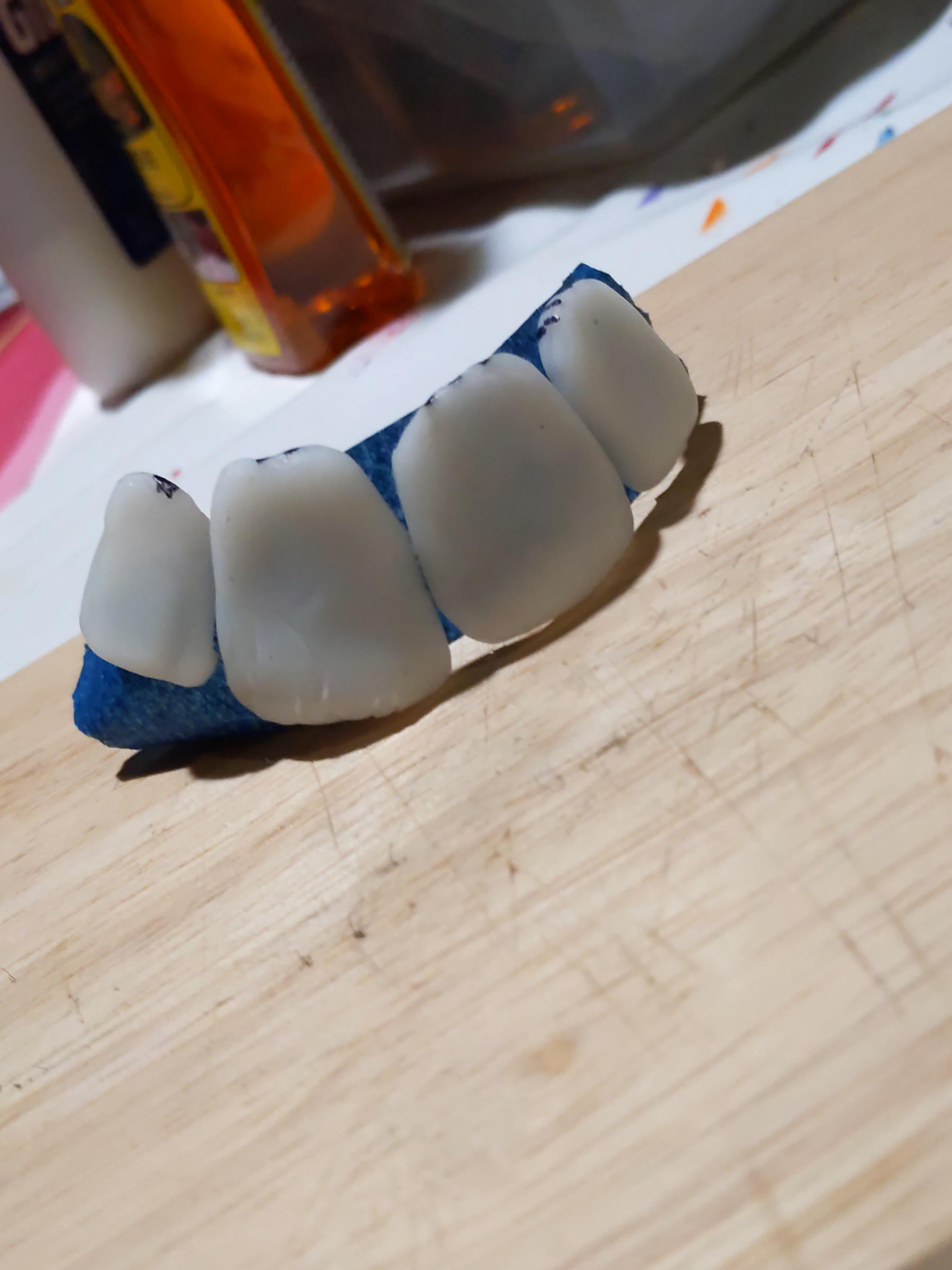 The same teeth, arranged in a curve approximating their final position in the mask. (not shown)