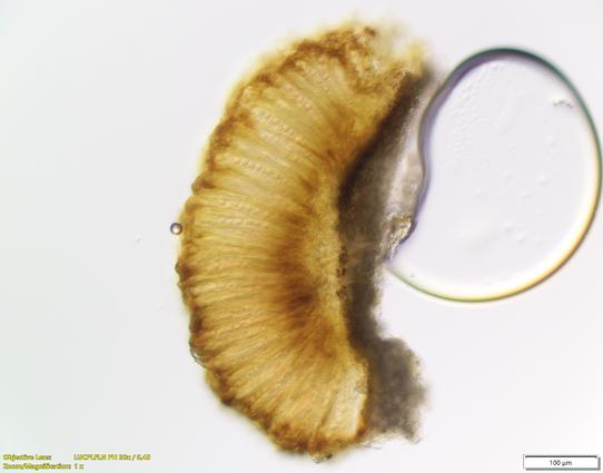 Apothecium with pale brown colour.