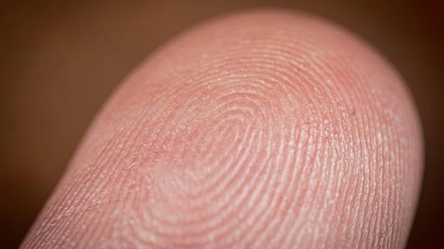 Photo of a finger.