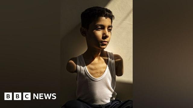 Mahmoud Ajjour, aged 9, pictured by a wall. He is wearing a white vest and has both arms missing