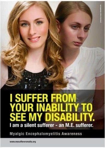 I suffer from your inability to see my disability.
I am a silent sufferer-an ME sufferer.
Myalgic Encephalomyelitis Awareness
