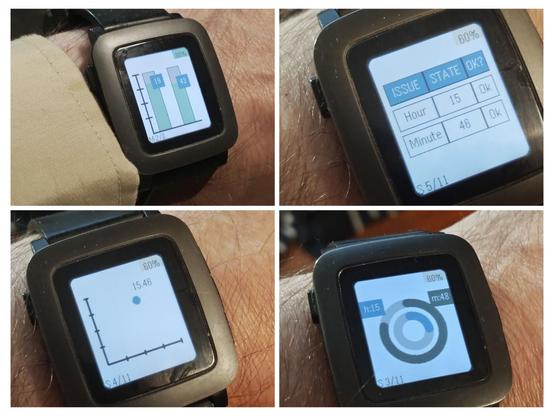 Neljän kuvan ruudukko. Kussakin on lähikuvassa ranteessa kello, jossa kussakin erilainen kellotaulu: pylväsdiagrammi, taulukko, ympyräkaavio tai aika tuntien ja minuuttien xy-koordinaatistossa. 
