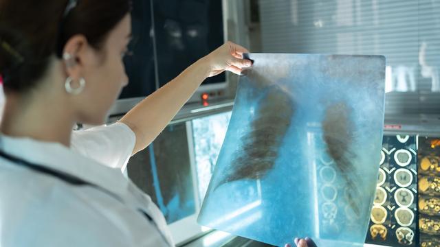 Une radiologue examine un film radiographique thoracique d'un patient dans un laboratoire.