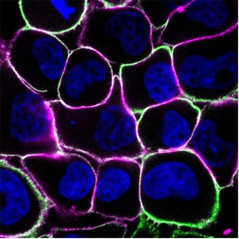 Every tumor cell type tested by the researchers — including this group of human breast cancer cells — required cooperation to survive under amino acid scarcity. Cell nuclei are labelled with Hoechst (blue) and cell membranes are labelled with antibodies against an amino acid transporter (green) and a membrane-bound enzyme (magenta). [Carmofon lab/NYU]