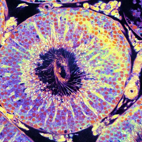 In rat testis a complex structure of the spermatozoa tails nest in a central spiral. NoRI’s findings about the testes may one day help us treat testicular cancer.