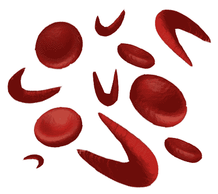 :sickle_RBC: