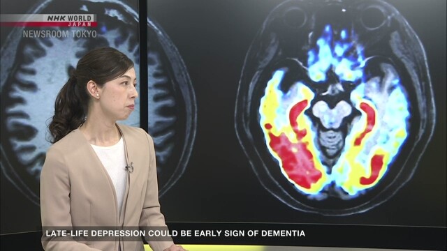 Late-life depression may be an early sign of dementia - nhk.or.jp