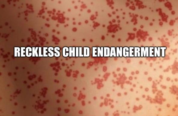 Measles skin with caption "reckless child endangerment"