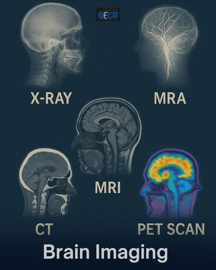 The image provides a visual comparison of different brain imaging techniques. It features five distinct types of brain scans: X-Ray, MRA, MRI, CT, and PET Scan. Each technique is represented by an image of a brain or skull with varying levels of detail and color. X-Ray shows a skeletal structure, MRA highlights blood vessels, MRI provides detailed brain anatomy, CT offers a cross-sectional view, and PET Scan displays metabolic activity. The image is titled "Brain Imaging" and includes a watermark "OECU" in the top center.