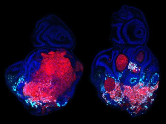 The image shows Drosophila larva eye-antennal discs (EAD, marked in blue), an epithelial structure that develops into the adult antenna and eye. Through a genetic manipulation system, these EAD harbor malignant RasV12 , scrib- tumour clones (marked in red). The authors show that tumor cells utilize Toll-NFkB signaling and the transcription factor chinmo to suppress neuronal eye differentiation (elav staining shown in cyan). Removal of chinmo (EAD shown on the right) results in lower tumour growth and increased differentiation within tumour cells (control EAD on the left).