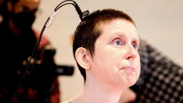 Schlaganfall: Dank Neuroprothese kann sie nach 18 Jahren wieder sprechen | Leben & Wissen