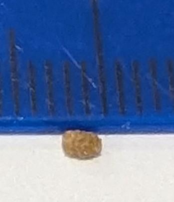 Smoothish kidney stone, 2mm long by 1.25mm wide. Like a fat grain of brown rice.